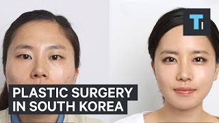 Plastic surgery in South Korea [upl. by Aciemaj]