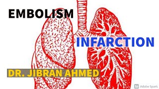 GENERAL PATHOLOGY II CHAPTER 4 II EMBOLISM amp INFARCTION II ROBBINS 10TH EDITION [upl. by Ardnazxela]