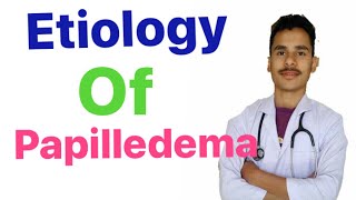 Etiology of papilledema [upl. by Aienahs781]