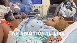 THE LIVE BIRTH OF OUR SECOND SET OF TWINS  Real Raw amp Emotional Doctor Turns Breech Baby in Womb [upl. by Icnan]