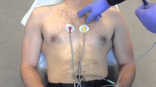 12 Lead ECG Placement example [upl. by Lomasi171]