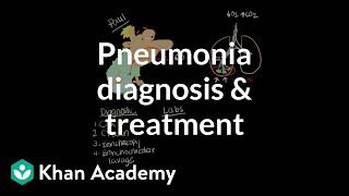 Pneumonia diagnosis and treatment  Respiratory system diseases  NCLEXRN  Khan Academy [upl. by Ahker]