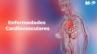 Enfermedades cardiovasculares [upl. by Aker]