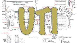 Urinary Tract Infection UTI Symptoms Causes amp Risk Factors [upl. by Eiramait]