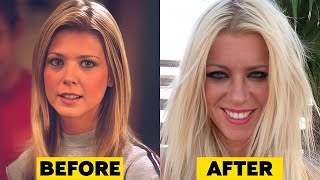 25 Actresses Plastic Surgery Disasters [upl. by Frey]