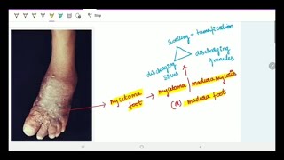 Actinomycetes Microbiology Morphology pathophysiology symptoms diagnosis treatment [upl. by Schultz]