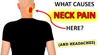 What Causes Upper Neck Pain And Headaches [upl. by Araed416]