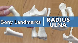 Bony Landmarks of the Radius and Ulna [upl. by Aniri]