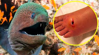 The Most POISONOUS And VENOMOUS FISHES In The World [upl. by Tereve]