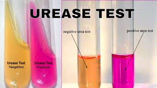 Urea Hydrolysis Urease Test [upl. by Blanchard]