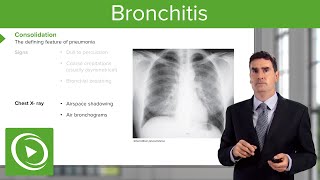 Pneumonia Introduction amp Types – Respiratory Medicine  Lecturio [upl. by Lemor329]