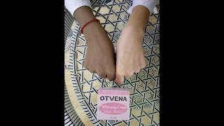 OTVENA Dark Spot Remover Skin Whitening Cream Review [upl. by Narod801]