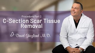 embrace® Active Scar Defense Application  CSection [upl. by Benildas]