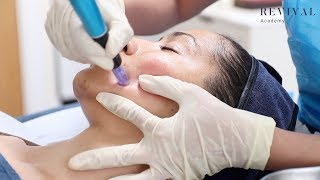 Microneedling Full Training Video [upl. by Lemyt]