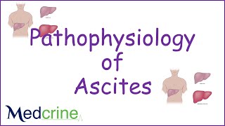 pathophysiology of ascites [upl. by Howell243]