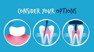 An Effective Alternative to Standard Root Canal Treatment [upl. by Marjorie844]