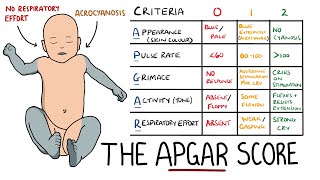 APGAR Score Made Easy  Newborn Assessment APGAR Mnemonic [upl. by Ynnek]