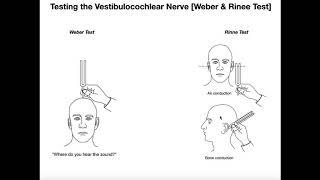 Interpreting the WeberRinne Tests EXPLAINED [upl. by Ylremik]