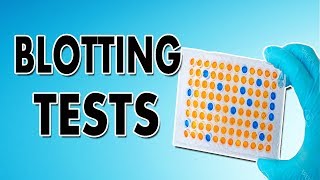 Blotting Techniques Western Blot Southern Blot and Northern Blot [upl. by Jerrol]