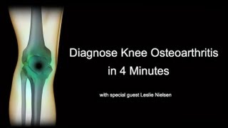 Diagnose Knee Osteoarthritis in 4 Minutes with Leslie Nielsen [upl. by Panther]