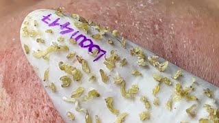 Satisfying With Loan Nguyen Spa Video 011 [upl. by Ysset]