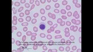 Classificação de Leucócitos [upl. by Jopa]