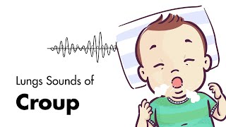 Sounds of Croup Laryngotracheitis  Lung Sounds  MEDZCOOL [upl. by Fatsug165]