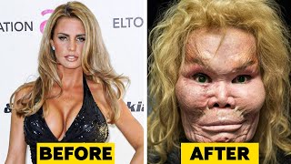 20 Celebrity Plastic Surgery Disasters [upl. by Alor18]