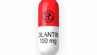 Epilepsy Expert Discusses Dilantin long term problems [upl. by Irtimed543]