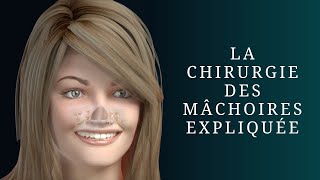 La chirurgie des mâchoires expliquée [upl. by Hal]