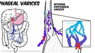 Hypertension artérielle  HTA  Docteur Synapse [upl. by Ithaman]