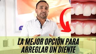 ¿Qué es mejor para dientes frontales CARILLAS ó RESINA [upl. by Cand986]