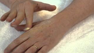 Cesarean Scar Massage  6 Weeks Postpartum [upl. by Lorens400]