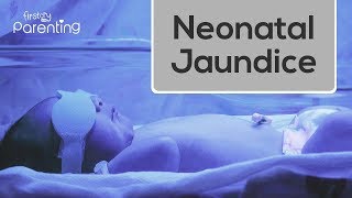 Neonatal Jaundice  Causes Symptoms and Treatment [upl. by Ardussi]