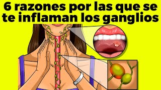 6 RAZONES POR LAS QUE SE TE INFLAMAN LOS GANGLIOS [upl. by Cheyne]