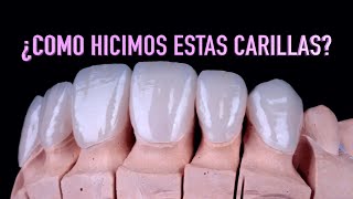 Cómo se hacen las carillas dentales  Proceso realización carillas dentalesDr Roberto Wuotto [upl. by Laro625]