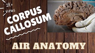 Corpus callosum  Air Anatomy [upl. by Driscoll880]