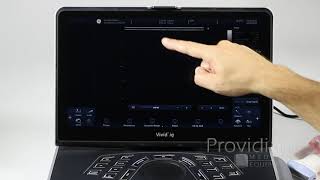 GE Vivid iq Training Part 1 Understanding and Using the New Interface [upl. by Keligot]