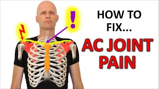 SI Joint Anatomy Biomechanics amp Prevalence [upl. by Hamilah353]