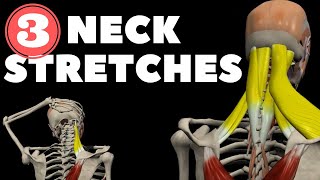 10 Best Stiff Neck Pain Relief Stretches [upl. by Arraeit]