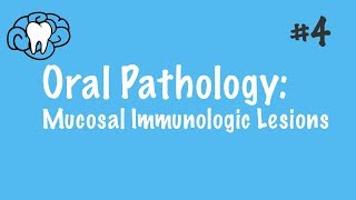 Oral Pathology  Mucosal Immunologic Diseases  INBDE ADAT [upl. by Knowles]