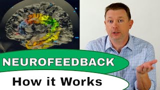 How Does Neurofeedback Therapy Work [upl. by Fleece]