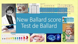 BALLARD NEW BALLARD SCORE TEST DE BALLARD [upl. by Yrak]