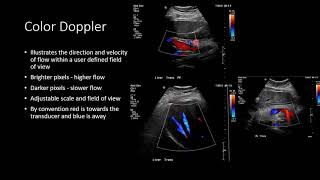 Ultrasound Physics  Types of Doppler Ultrasound [upl. by Carolin]