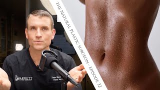 32 Everything You Need To Know About Liposuction [upl. by Bradeord]