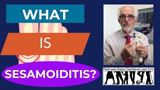 What Is Sesamoiditis [upl. by Lanctot853]