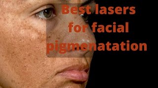 How to treat skin pigmentation [upl. by Darin]