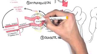 Chronic Kidney Disease CKD Pathophysiology [upl. by Rici]