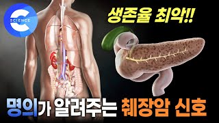 이게 있으면 췌장암 가능서 높아요 당장 검사 받으세요 [upl. by Sible]