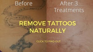 How To Remove Tattoos Naturally [upl. by Yakcm287]